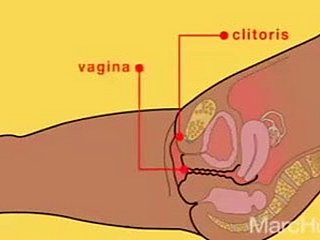 วิธีการฉีด