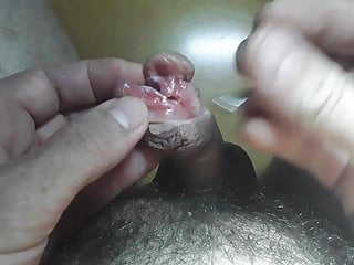 Menusuk dan subincision